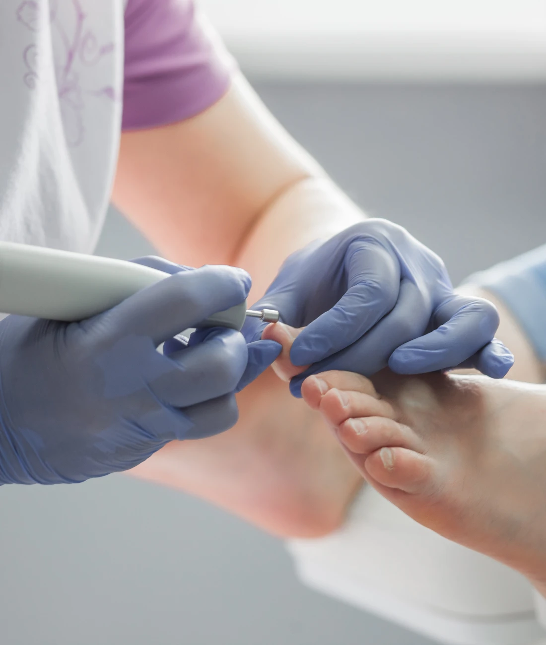 Podologische Komplexbehandlung mit Fußpflegegerät an Füßen.